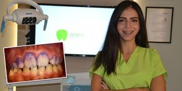 denta-vita-sila-saatcioglu